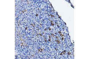 Immunohistochemistry (IHC) image for anti-Lymphocyte-Specific Protein tyrosine Kinase (LCK) (AA 1-240) antibody (ABIN3023130)