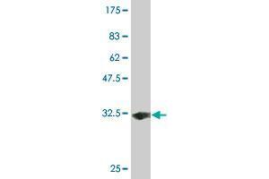 Solute Carrier Family 35 (UDP-GlcNAc/UDP-Glucose Transporter), Member D2 (SLC35D2) (AA 74-131) Antikörper