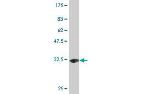 Solute Carrier Family 35 (UDP-GlcNAc/UDP-Glucose Transporter), Member D2 (SLC35D2) (AA 74-131) Antikörper