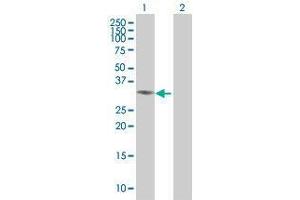 Western Blotting (WB) image for BCL11A 293T Cell Transient Overexpression Lysate(Denatured) (ABIN1336524)