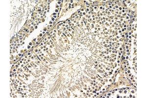 ABIN7096656 and ABIN7100721 at 1/100 staining rat testis tissue by IHC-P. (CHRND Antikörper)