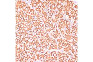 Immunohistochemistry of paraffin-embedded rat ovary using MEK3 antibody (ABIN6130544, ABIN6143484, ABIN6143485 and ABIN6223650) at dilution of 1:100 (40x lens). (MAP2K3 Antikörper  (AA 1-170))