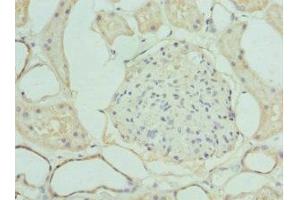 Immunohistochemistry (IHC) image for anti-LIM and Senescent Cell Antigen-Like Domains 1 (LIMS1) (AA 1-325) antibody (ABIN7158341)