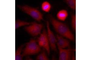 Immunofluorescenitrocellulosee of human HeLa cells stained with Hoechst 3342 (Blue) for nucleus staining and monoclonal anti-human GAPDH antibody (1:500) with Texas Red (Red). (GAPDH Antikörper  (AA 1-335))