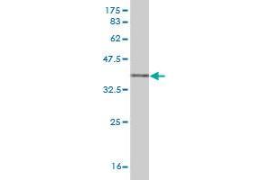 Western Blotting (WB) image for anti-Matrix Metallopeptidase 13 (Collagenase 3) (MMP13) (AA 362-471) antibody (ABIN517973)