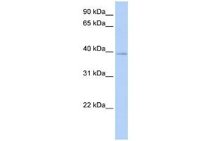 WB Suggested Anti-HOXC10 Antibody Titration:  0. (HOXC10 Antikörper  (N-Term))