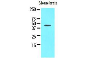 The extracts of mouse brain (50ug) were resolved by SDS-PAGE, transferred to NC membrane and probed with anti-human Homer1 (1:1000). (HOMER1 Antikörper)
