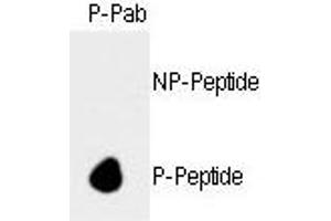Image no. 1 for anti-Retinoblastoma 1 (RB1) (pSer788) antibody (ABIN358214) (Retinoblastoma 1 Antikörper  (pSer788))