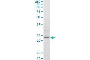 ATG5 monoclonal antibody (M05), clone 1E7. (ATG5 Antikörper  (AA 176-275))
