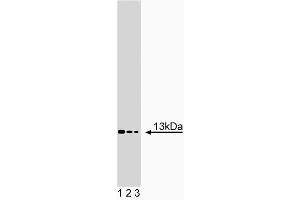 Western blot analysis of Acid Ceramidase on NHEK lysate. (ASAH1 Antikörper  (AA 88-182))