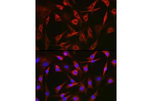 Immunofluorescence analysis of NIH-3T3 cells using FAK Rabbit pAb (ABIN6131638, ABIN6146424, ABIN6146426 and ABIN6215254) at dilution of 1:100 (40x lens). (FAK Antikörper  (AA 425-660))