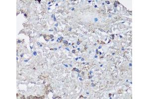 Immunohistochemistry of paraffin-embedded Human lung using NLRC4 Polyclonal Antibody at dilution of 1:100 (40x lens). (NLRC4 Antikörper)