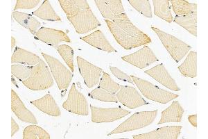 LGR5 Mouse Monoclonal Antibody at 1/100 staining mouse muscle tissue by IHC-P.