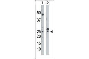 The anti-UCK Pab (ABIN392730 and ABIN2842193) is used in Western blot to detect UCK in mouse cerebellum tissue lysate (Lane 1) and HepG2 cell lysate (Lane 2). (UCK Antikörper  (N-Term))