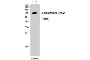 Western Blotting (WB) image for anti-Intestinal Cell (MAK-Like) Kinase (ICK) (pTyr159) antibody (ABIN3173080) (ICK Antikörper  (pTyr159))
