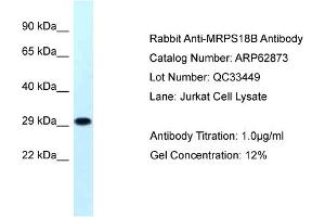 Western Blotting (WB) image for anti-Mitochondrial Ribosomal Protein S18B (MRPS18B) (N-Term) antibody (ABIN2774354)