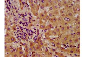 IHC image of ABIN7143530 diluted at 1:600 and staining in paraffin-embedded human liver tissue performed on a Leica BondTM system. (NUDT5 Antikörper  (AA 34-166))