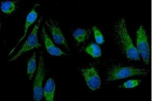 anti-Mitochondrially Encoded NADH Dehydrogenase 5 (MT-ND5) (AA 154-570) antibody