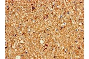 Immunohistochemistry of paraffin-embedded human brain tissue using ABIN7163965 at dilution of 1:100 (KCNC1 Antikörper  (AA 1-190))