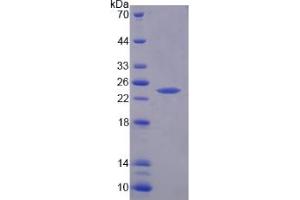 SDS-PAGE analysis of Rat RIPK1 Protein. (RIPK1 Protein)