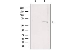 Western blot analysis of extracts from rat muscle, using SQLE antibody. (SQLE Antikörper  (C-Term))
