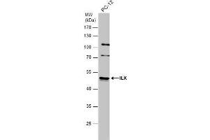 Western Blotting (WB) image for anti-Integrin-Linked Kinase (ILK) antibody (ABIN2854345)