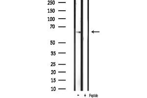 anti-P21-Activated Kinase 1 (PAK1) (pThr212) antibody