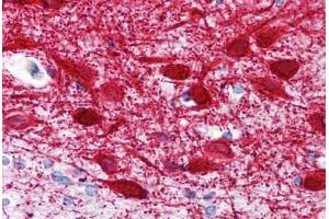 Human Brain, Cortex (formalin-fixed, paraffin-embedded) stained with MAP2 antibody ABIN239820 at 10 ug/ml followed by biotinylated anti-mouse IgG secondary antibody ABIN481714, alkaline phosphatase-streptavidin and chromogen. (MAP2 Antikörper  (AA 1375-1395))