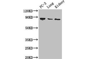 Western Blot Positive WB detected in: PC-3 whole cell lysate, Mouse lung tissue, Mouse kidney tissue All lanes: CARS antibody at 3 μg/mL Secondary Goat polyclonal to rabbit IgG at 1/50000 dilution Predicted band size: 86, 83, 95 kDa Observed band size: 86 kDa (CARS Antikörper  (AA 201-500))