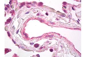 Anti-VEGF antibody IHC of human lung, vascular endothelium. (VEGFA Antikörper)