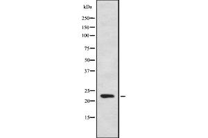 Western blot analysis of CYB561D1 using HeLa whole cell lysates (CYB561D1 Antikörper  (C-Term))