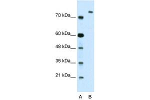 WB Suggested Anti-ZMYM3 Antibody Titration:  2. (ZMYM3 Antikörper  (N-Term))