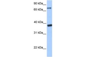 Western Blotting (WB) image for anti-Death Inducer-Obliterator 1 (DIDO1) antibody (ABIN2461923) (DIDO1 Antikörper)