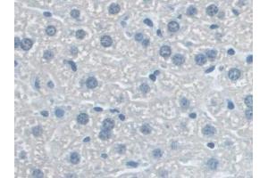 Immunohistochemistry (IHC) image for anti-NLR Family, Pyrin Domain Containing 3 (NLRP3) (AA 671-1033) antibody (ABIN7443710)