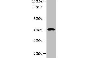 Western blot All lanes: CCDC24 antibody at 6 μg/mL + MCF-7 whole cell lysate Secondary Goat polyclonal to rabbit IgG at 1/10000 dilution Predicted band size: 35, 31 kDa Observed band size: 35 kDa (CCDC24 Antikörper  (AA 1-307))