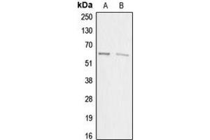 Western blot analysis of ACRBP expression in HEK293T (A), HeLa (B) whole cell lysates. (ACRBP Antikörper  (Center))