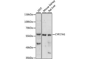 Western blot analysis of extracts of various cell lines, using CYP27 antibody (982) at 1:1000 dilution. (CYP27A1 Antikörper  (AA 200-400))