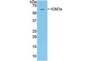 Detection of Recombinant MAP2K4, Human using Polyclonal Antibody to Mitogen Activated Protein Kinase Kinase 4 (MAP2K4) (MAP2K4 Antikörper  (AA 137-394))