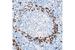 Immunohistochemistry of paraffin-embedded Human tonsil using IGHD antibody (ABIN7267824) at dilution of 1:100 (40x lens). (IgD Antikörper)