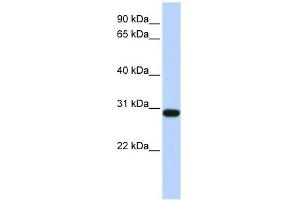BPGM antibody used at 1 ug/ml to detect target protein. (BPGM Antikörper  (Middle Region))