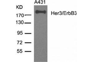 Image no. 3 for anti-Receptor Tyrosine-Protein Kinase ErbB-3 (ERBB3) (AA 1326-1330) antibody (ABIN319384) (ERBB3 Antikörper  (AA 1326-1330))