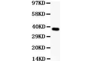 Western Blotting (WB) image for anti-Cell Adhesion Molecule 1 (CADM1) (AA 45-340) antibody (ABIN3043770)