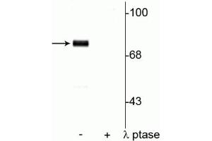 Western blot of rat cortical lysate showing specific immunolabeling of  the ~78 kDa synapsin I phosphorylated at Ser9 in the first lane (-). (SYN1 Antikörper  (pSer9))