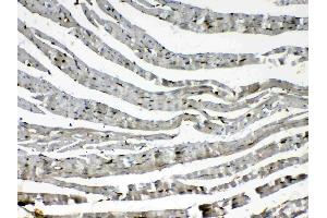 Immunohistochemistry (IHC) image for anti-Cytoglobin (CYGB) (AA 1-190) antibody (ABIN5518753)
