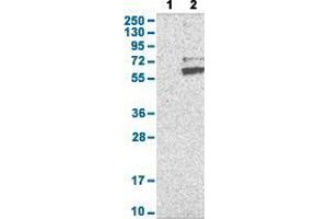 Western Blot analysis with RNF149 polyclonal antibody . (RNF149 Antikörper  (AA 250-383))