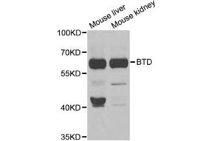 Western blot analysis of extracts of various cell lines, using BTD antibody (ABIN5973709) at 1/1000 dilution.
