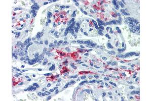 Anti-CD163 antibody IHC of human placenta. (CD163 Antikörper)