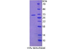 Image no. 1 for ADAM Metallopeptidase Domain 12 (ADAM12) (AA 513-767) protein (His tag) (ABIN6237285) (ADAM12 Protein (AA 513-767) (His tag))
