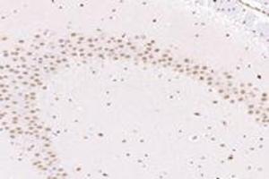 Immunohistochemistry analysis of paraffin-embedded mouse substantia nigra using NUP133 (ABIN7074909) at dilution of 1: 4800 (NUP133 Antikörper)