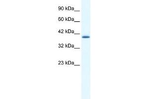 WB Suggested Antibody Titration:  0. (ZNF365 Antikörper  (N-Term))